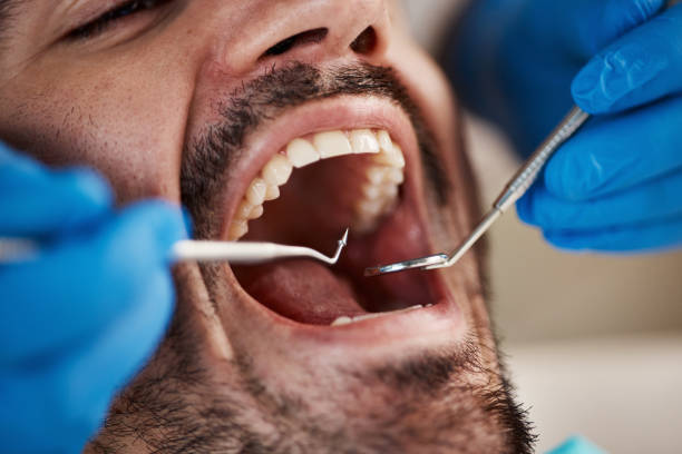 Best Emergency Dental Care  in Mangum, OK